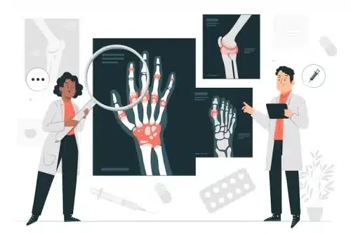 Meat Arthritis
