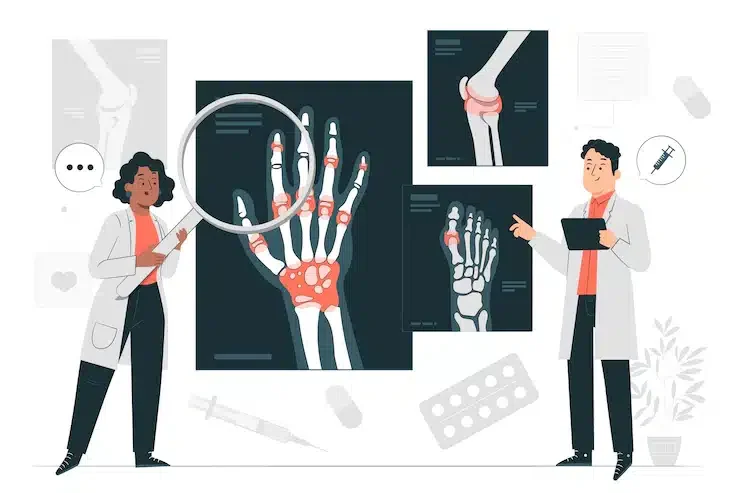 Meat Arthritis
