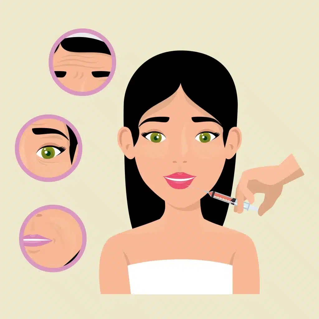 Botox para arrugas debajo de los ojos